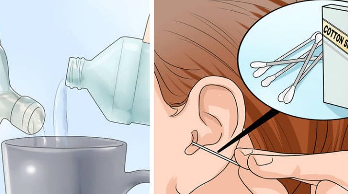 2-Ingredient Mixture to EFFECTIVELY Eliminate Earwax and Ear Infections