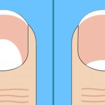 The Moons on Your Nails Can Indicate These 13 Health Problems