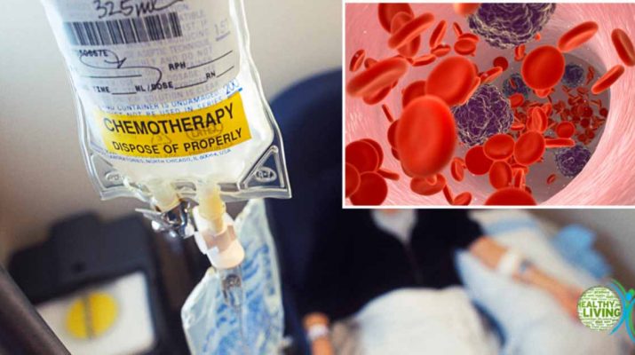 Chemotherapy Is Spreading Cancer Instead of Stopping It