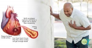 New discovery could reverse tissue damage caused by heart attacks
