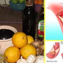 No More Pills for Bad Cholesterol or High Blood Pressure. Take This Remedy for 1 Week!