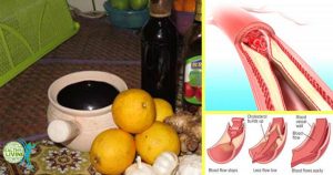 No More Pills for Bad Cholesterol or High Blood Pressure. Take This Remedy for 1 Week!