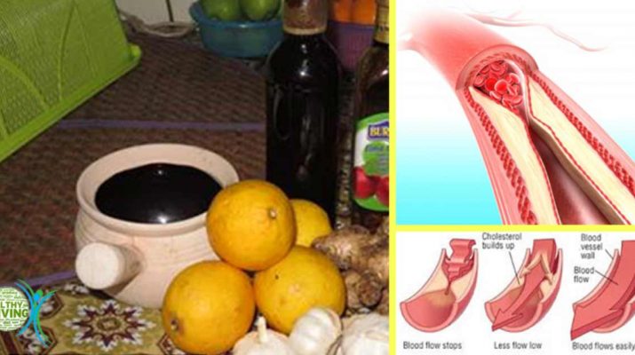 No More Pills for Bad Cholesterol or High Blood Pressure. Take This Remedy for 1 Week!