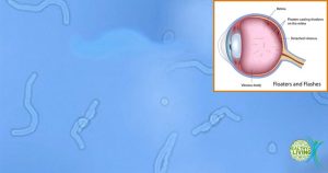 Scientists Discover a New Way to Reduce Your Eye Floaters!