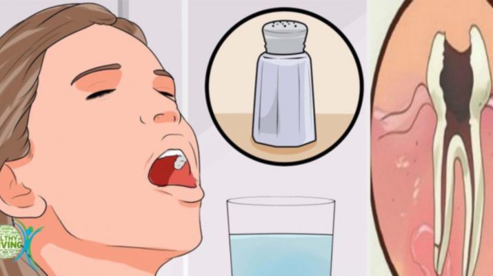 11 Natural Ways to Ease Your Toothache