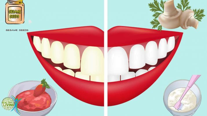 Get Rid of Bad Breath, Dental Plaque and Cavities! Get Whiter Teeth!