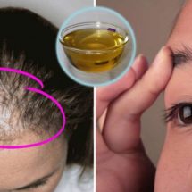Incredible Oil Prevents Hair Loss and Stimulates Its Growth
