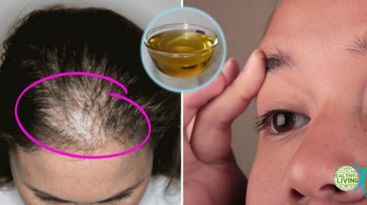 Incredible Oil Prevents Hair Loss and Stimulates Its Growth