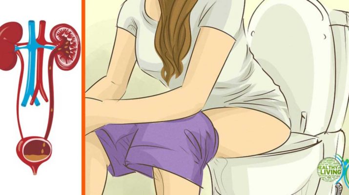 Treat Urinary Tract Infections with These 8 Home Solutions