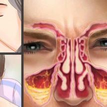 3 Simple Tricks to Unclog Your Sinuses at Home