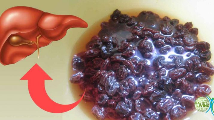 Detox Your Liver Naturally Using Raisins and Water