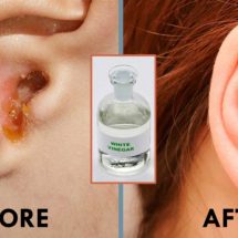 The Best Way to Clean Your Ears Naturally