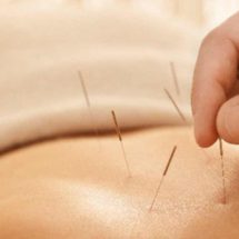 Which Health Conditions Can Be Treated with Acupuncture