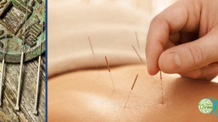 Which Health Conditions Can Be Treated with Acupuncture