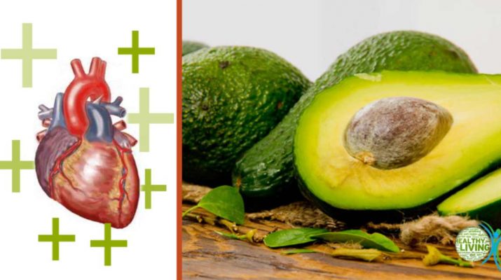 7 Reasons Why You Should Start Eating Avocados Today
