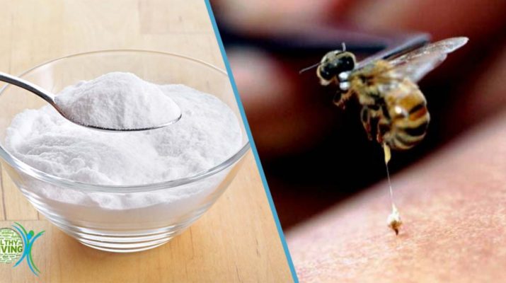 7 Best Ways to Treat Bee Stings at Home