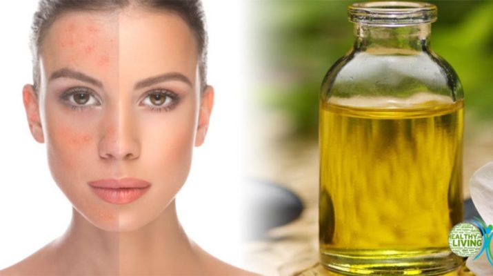How Castor Oil Boosts the Immune and Lymphatic System