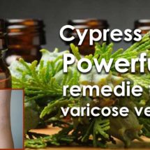 Get Rid of Varicose Veins with These Powerful Essential Oils