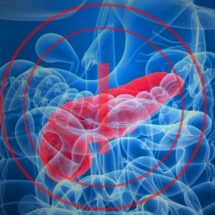 Watch Out for These Signs of Pancreatic Cancer