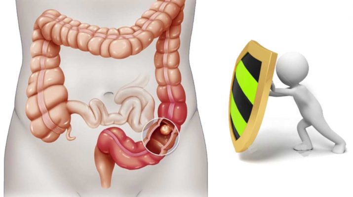 Best Tips to Prevent Colon Cancer