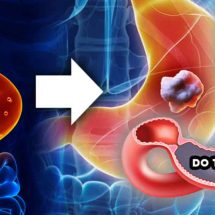 Low Stomach Acid Test