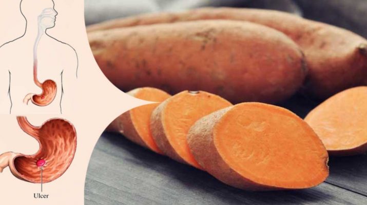 Treat Diabetes, Stomach Ulcer, and Heart Health with Sweet Potatoes