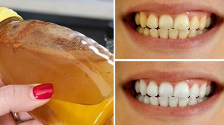 Make Pearl White Teeth With This Simple Ingredient That You Have at Home