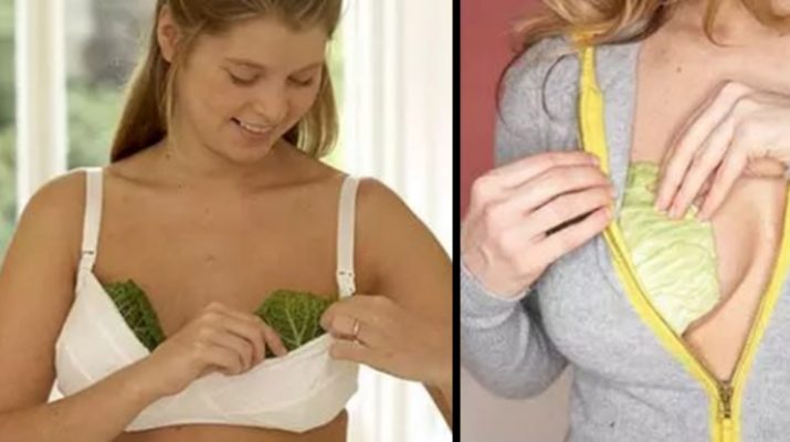 Cabbage Leaves Used as a Relief for Swollen Breasts