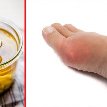 Reduce Inflammation in Varicose Veins with Homemade Garlic Oil