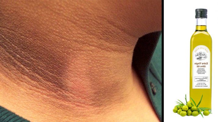 A 15-Minute Treatment for Dark Spots on the Neck, Inner Thighs and Underarms