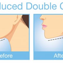 Facial Yoga: How to Eliminate Your Double Chin – Fast!