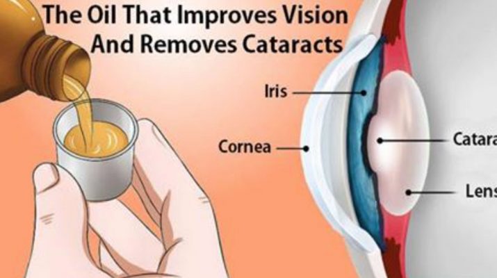 How to Use the Oil That Treats Cataracts