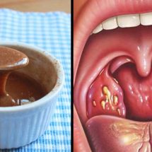 This Is How to Get Rid of Throat Phlegm