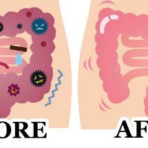 Eliminate Pounds of Waste from Your Colon by Using a 2 Ingredient Remedy
