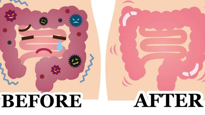 Eliminate Pounds of Waste from Your Colon by Using a 2 Ingredient Remedy