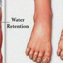 The Signs Behind Water Retention and How to Stop It