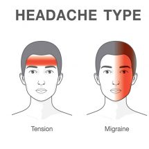 This is How Headaches Reveal What is Wrong With Your Health.