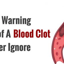 8 Early Warning Signs of A Blood Clot to Never Ignore