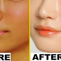 Do This For 15 Minutes Before Going To Bed, It Can Change Your Skin Complexion Overnight!!!