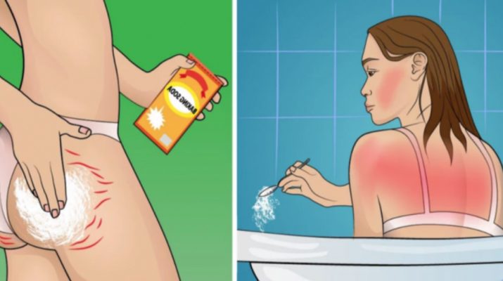 Every-Woman-Should-Know-These-12-Tricks-With-Baking-Soda