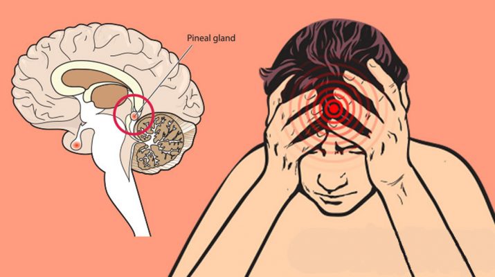 How-Fluoride-Damages-the-Human-Brain,-Especially-the-Pineal-Gland