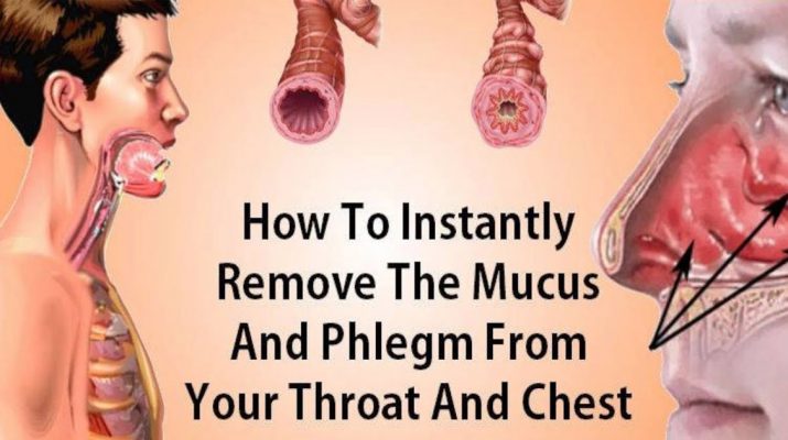 How-To-Eliminate-Mucus-And-Phlegm-From-Your-Throat-And-Chest