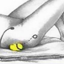 How To Stop Sciatic Nerve Pain And Back Pain With Just A Tennis Ball