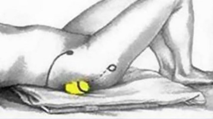 How-To-Stop-Sciatic-Nerve-Pain-And-Back-Pain-With-Just-A-Tennis-Ball