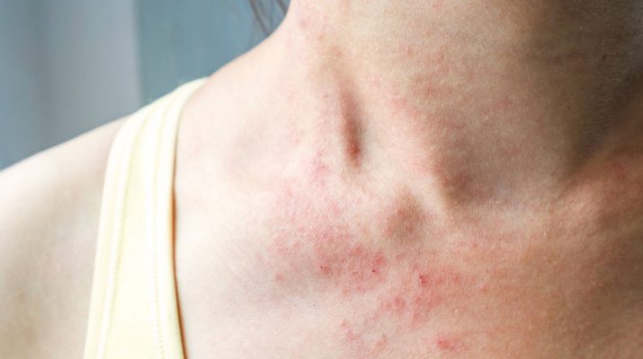 10-Things-Itchy-Skin-Says-About-Your-Health