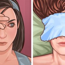 5+ Home Remedies For Itchy Eyes