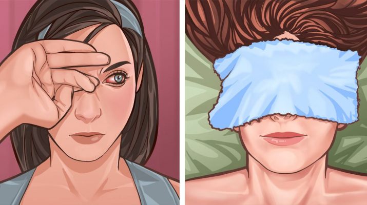 5+-Home-Remedies-For-Itchy-Eyes