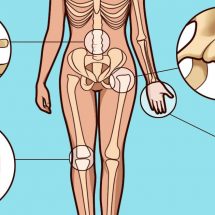 Do You Suspect You Have Arthritis? How To Spot The Early Symptoms