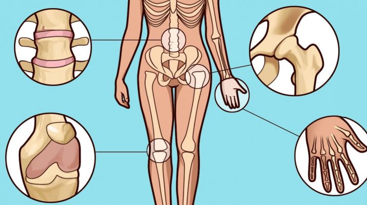 Do-You-Suspect-You-Have-Arthritis-How-To-Spot-The-Early-Symptoms