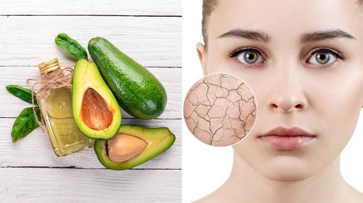 Got-Dry-Skin-Here's-Why-You-NEED-Avocado-Oil